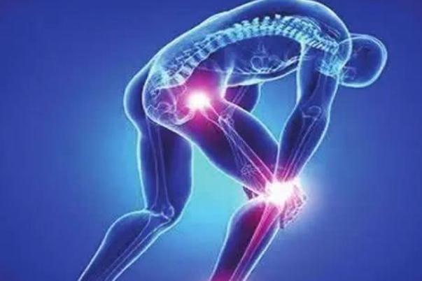 關(guān)節(jié)炎有積液怎么治療 關(guān)節(jié)炎有積液嚴重嗎