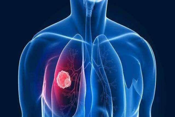 肺結(jié)核會(huì)導(dǎo)致不孕不育嗎 肺結(jié)核會(huì)導(dǎo)致輸卵管堵塞嗎 肺結(jié)核會(huì)導(dǎo)致不孕不育嗎 肺結(jié)核會(huì)導(dǎo)致輸卵管堵塞嗎