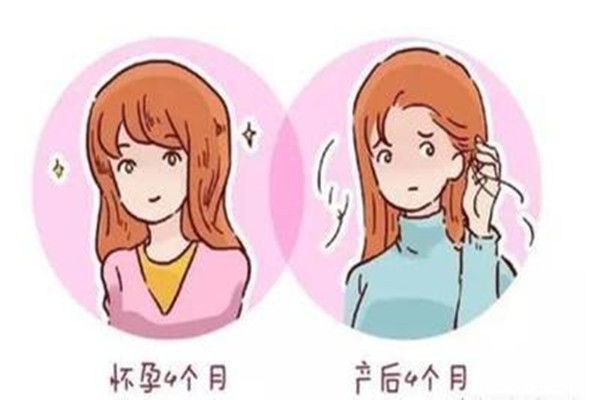 產后會脫發(fā)嗎 產后脫發(fā)什么原因 產后會脫發(fā)嗎 產后脫發(fā)什么原因