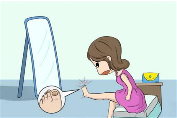 腳氣會傳染到身體其它部位嗎 腳氣會傳染給別人嗎 腳氣會傳染到身體其它部位嗎 腳氣會傳染給別人嗎