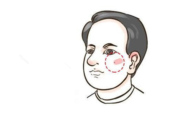 點(diǎn)痣有什么忌口 點(diǎn)痣有什么講究 點(diǎn)痣有什么忌口 點(diǎn)痣有什么講究