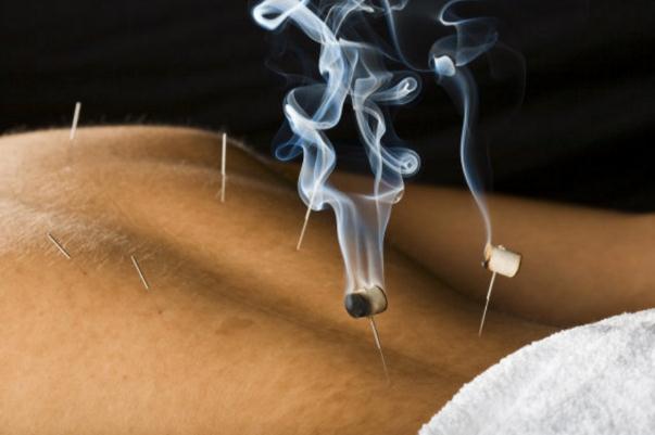 艾灸要隔著衣服嗎 艾灸要注意些什么事項 艾灸要隔著衣服嗎 艾灸要注意些什么事項