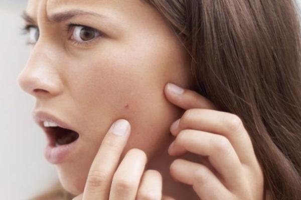 刷酸要刷幾次才有效果 刷酸要洗臉嗎 刷酸要刷幾次才有效果 刷酸要洗臉嗎