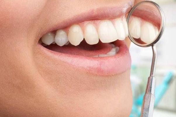 美白牙貼要貼多少分鐘 美白牙貼要天天用嗎 美白牙貼要貼多少分鐘 美白牙貼要天天用嗎