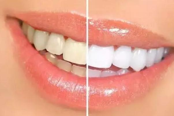 牙黃是身體哪里出問題了 牙齒越來越黃怎么回事 牙黃是身體哪里出問題了 牙齒越來越黃怎么回事