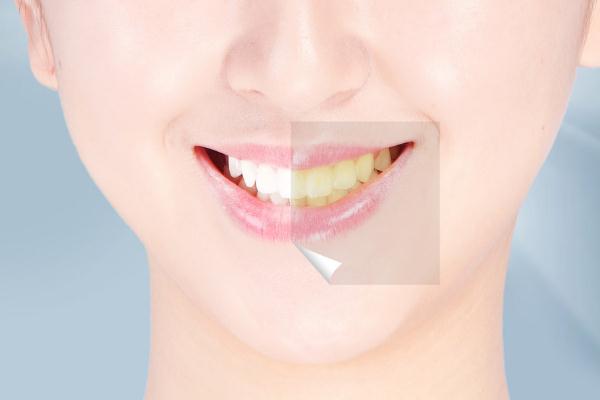 牙黃是身體哪里出問題了 牙齒越來越黃怎么回事 牙黃是身體哪里出問題了 牙齒越來越黃怎么回事