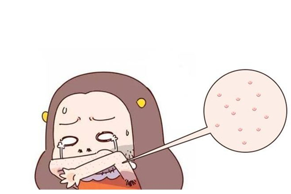 雞皮膚會隨著年齡的增長消除嗎 雞皮膚用什么藥膏最好 雞皮膚會隨著年齡的增長消除嗎 雞皮膚用什么藥膏最好