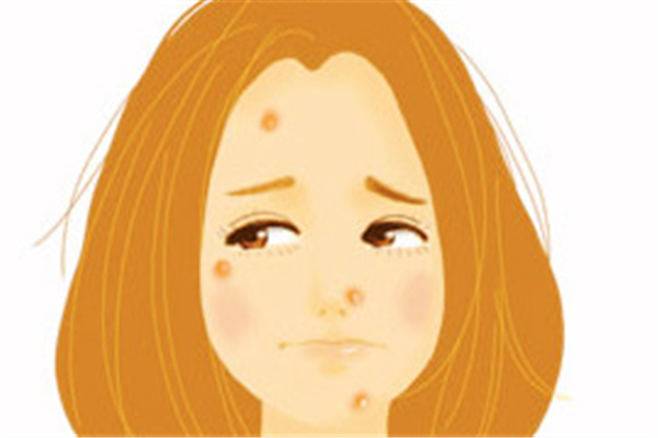 閉口和粉刺的區(qū)別 閉口和粉刺是一樣的嗎 閉口和粉刺的區(qū)別 閉口和粉刺是一樣的嗎