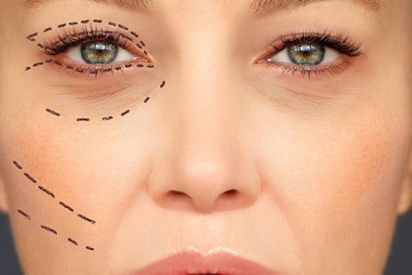 眼袋為什么有脂肪粒 眼袋為什么一個大一個小 眼袋為什么有脂肪粒 眼袋為什么一個大一個小