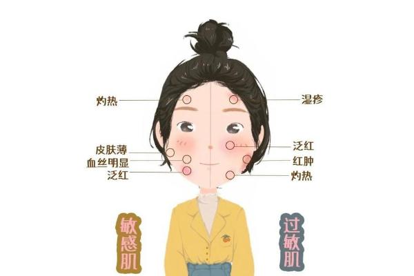 敏感肌膚的癥狀有哪些 敏感肌膚的特點 敏感肌膚的癥狀有哪些 敏感肌膚的特點