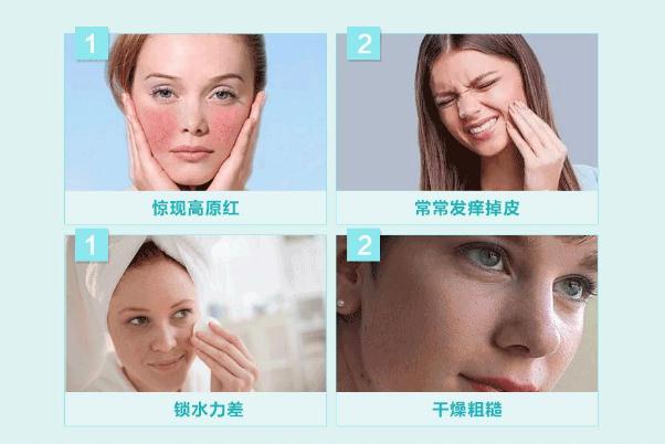 敏感肌怎樣修復(fù)成正常肌膚 敏感肌膚適合什么牌子的護膚品