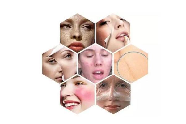 敏感肌膚的癥狀有哪些 敏感肌膚的特點 敏感肌膚的癥狀有哪些 敏感肌膚的特點