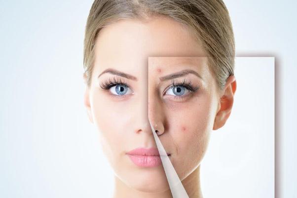 敏感肌膚的癥狀有哪些 敏感肌膚的特點 敏感肌膚的癥狀有哪些 敏感肌膚的特點