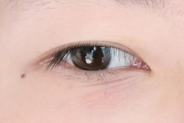 眼部細(xì)紋越來越多了怎么改善 眼部細(xì)紋松弛最好的解決辦法 眼部細(xì)紋越來越多了怎么改善 眼部細(xì)紋松弛最好的解決辦法