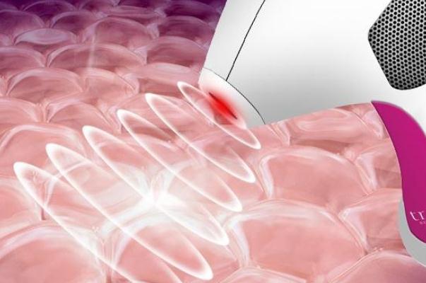 激光脫毛要脫幾次才干凈 激光脫毛要把毛刮干凈嗎 激光脫毛要脫幾次才干凈 激光脫毛要把毛刮干凈嗎