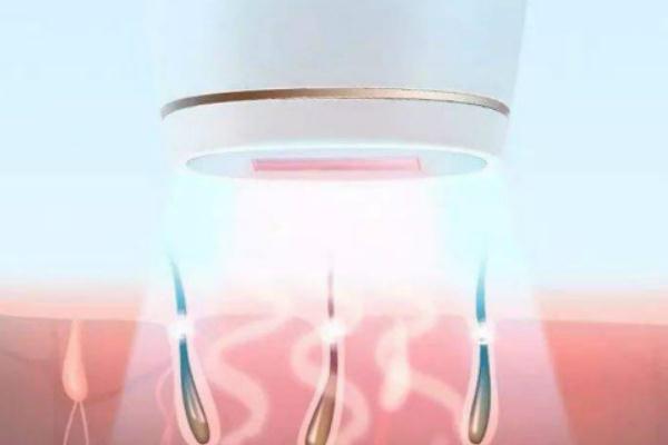 激光脫毛的注意事項(xiàng) 激光脫毛的副作用有哪些 激光脫毛的注意事項(xiàng) 激光脫毛的副作用有哪些