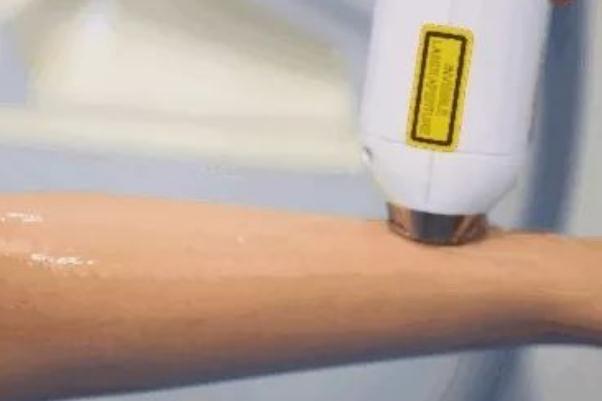 激光脫毛的注意事項(xiàng) 激光脫毛的副作用有哪些 激光脫毛的注意事項(xiàng) 激光脫毛的副作用有哪些