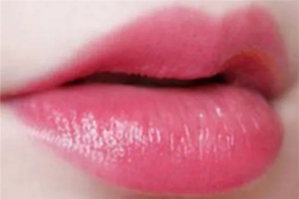 豐唇后多久可以涂口紅 豐唇后怎么護理 豐唇后多久可以涂口紅 豐唇后怎么護理