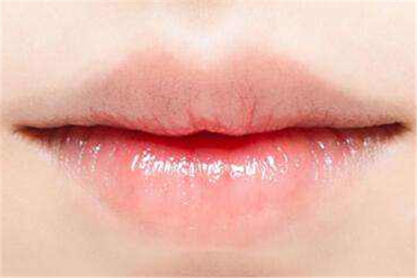豐唇后多久可以涂口紅 豐唇后怎么護理 豐唇后多久可以涂口紅 豐唇后怎么護理