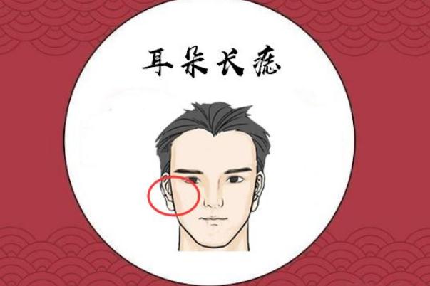 點(diǎn)痣是什么意思 點(diǎn)痣后要做好保護(hù)措施 點(diǎn)痣是什么意思 點(diǎn)痣后要做好保護(hù)措施