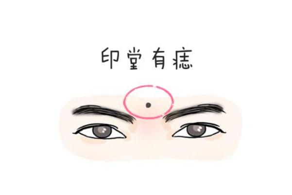 點(diǎn)痣是什么意思 點(diǎn)痣后要做好保護(hù)措施 點(diǎn)痣是什么意思 點(diǎn)痣后要做好保護(hù)措施