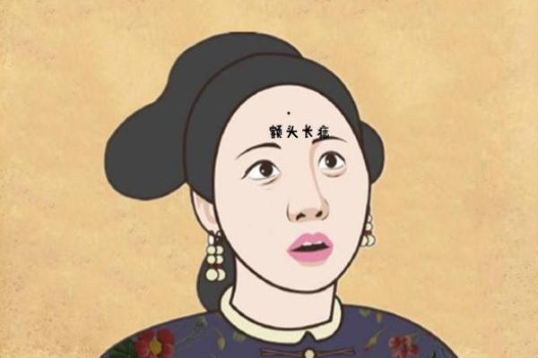 點(diǎn)痣的痂幾天脫落 點(diǎn)痣的印子多久能消除 點(diǎn)痣的痂幾天脫落 點(diǎn)痣的印子多久能消除