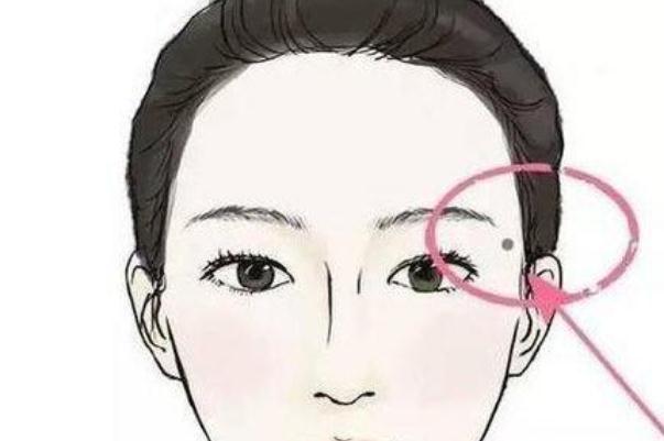 點痣會不會復(fù)發(fā) 點痣會留疤留坑嗎