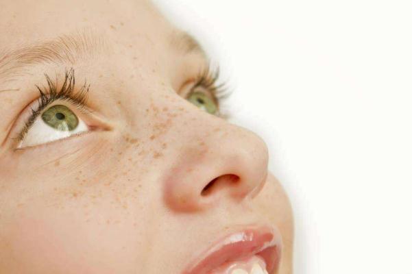 雀斑的形狀和顏色 雀斑的危害 雀斑的形狀和顏色 雀斑的危害
