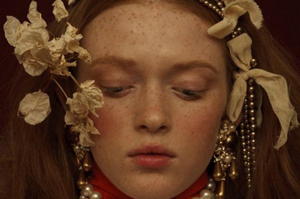 雀斑對身體有影響嗎 雀斑可以做光子嫩膚嗎 雀斑對身體有影響嗎 雀斑可以做光子嫩膚嗎