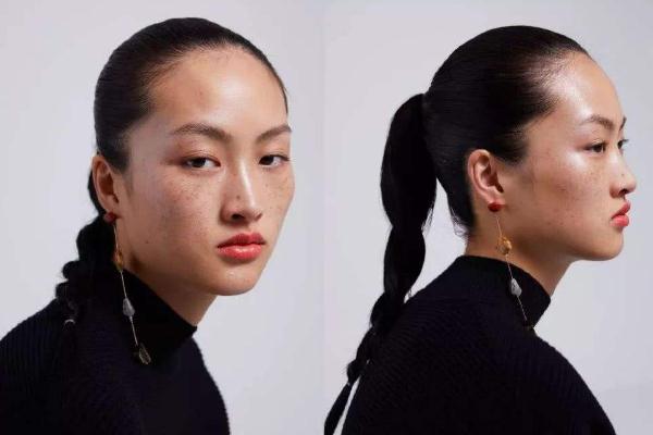 雀斑對身體有影響嗎 雀斑可以做光子嫩膚嗎 雀斑對身體有影響嗎 雀斑可以做光子嫩膚嗎