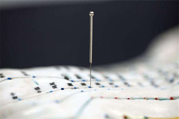 針灸后皮膚出現(xiàn)淤青是什么問題 針灸后會出現(xiàn)哪些癥狀 針灸后皮膚出現(xiàn)淤青是什么問題 針灸后會出現(xiàn)哪些癥狀