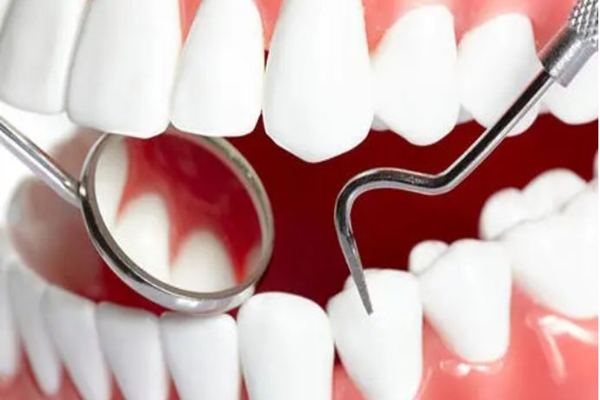 洗牙要多長時間 洗牙會導致牙齦萎縮嗎 洗牙要多長時間 洗牙會導致牙齦萎縮嗎