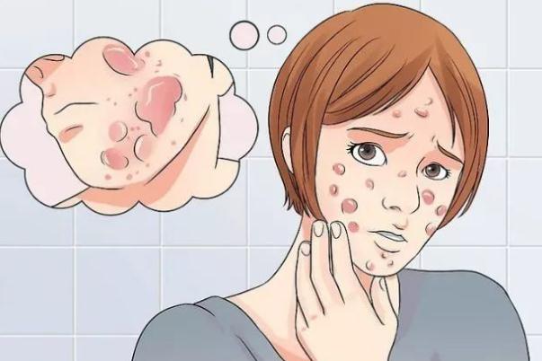 青春痘對身體有什么危害 長青春痘的好處與壞處