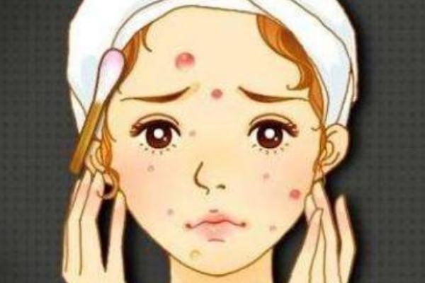 青春痘是皮膚病嗎 青春痘要擠掉嗎 青春痘是皮膚病嗎 青春痘要擠掉嗎