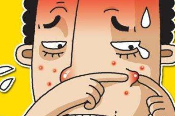 青春痘對身體有什么危害 長青春痘的好處與壞處