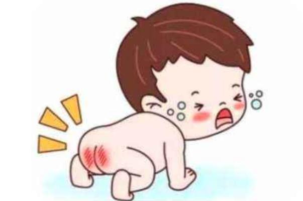 尿布疹的癥狀有哪些 尿布疹的預(yù)防要點是什么 尿布疹的癥狀有哪些 尿布疹的預(yù)防要點是什么