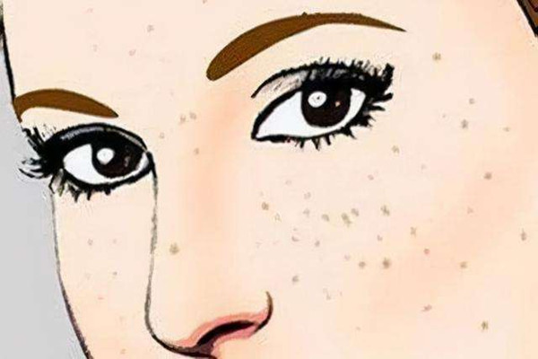 黃褐斑敷面膜有用嗎 黃褐斑敷什么面膜好 黃褐斑敷面膜有用嗎 黃褐斑敷什么面膜好