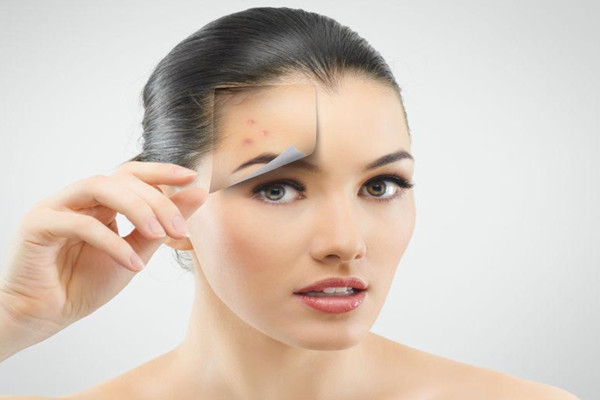 有粉刺可以化妝嗎 有粉刺可以刷酸嗎 有粉刺可以化妝嗎 有粉刺可以刷酸嗎