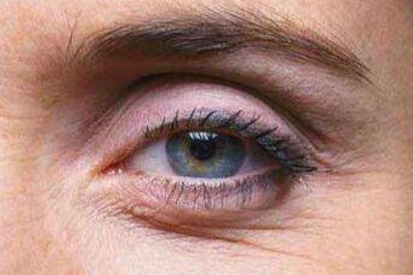 魚尾紋是什么樣子 魚尾紋是桃花紋嗎 魚尾紋是什么樣子 魚尾紋是桃花紋嗎