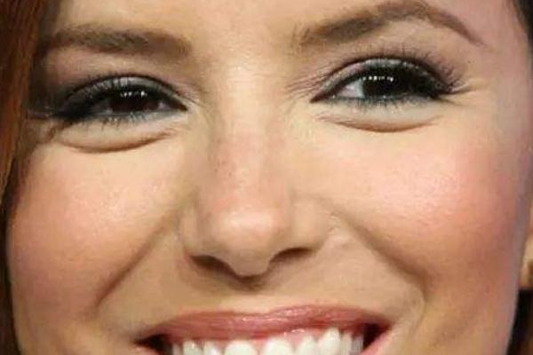 魚(yú)尾紋除皺針打一次能保持多久 魚(yú)尾紋除皺針有什么副作用