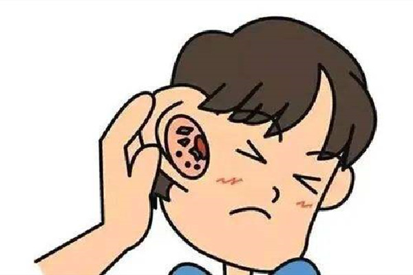 采耳有年齡限制嗎 采耳的工具是一次性的嗎 采耳有年齡限制嗎 采耳的工具是一次性的嗎