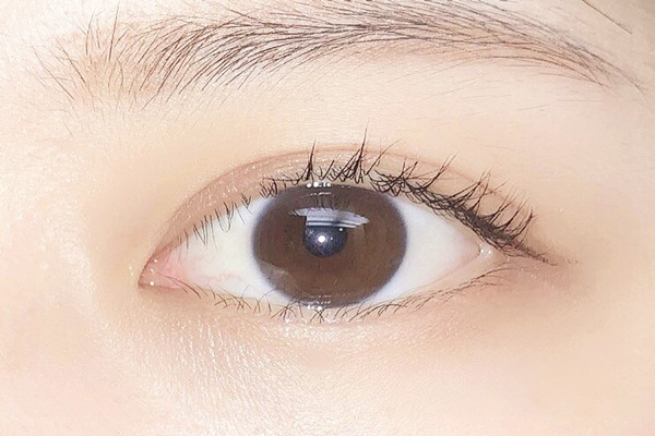 雙眼皮埋線后多久可以沾水 雙眼皮埋線后多久可以化妝 雙眼皮埋線后多久可以沾水 雙眼皮埋線后多久可以化妝