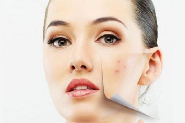 痘痘肌膚要涂防曬嗎 痘痘肌是先補(bǔ)水還是先祛痘 痘痘肌膚要涂防曬嗎 痘痘肌是先補(bǔ)水還是先祛痘