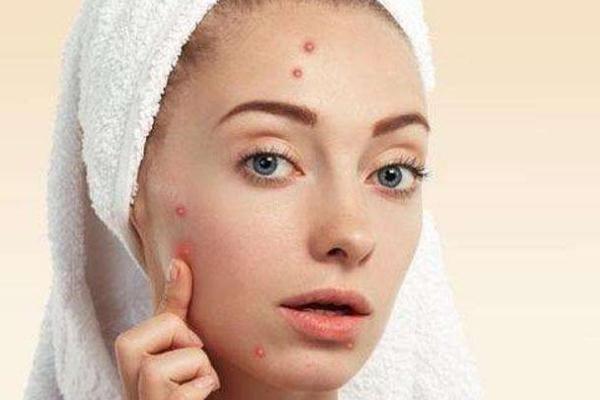 痘痘肌膚怎么修復(fù) 痘痘肌膚適合用什么牌子的護(hù)膚品 痘痘肌膚怎么修復(fù) 痘痘肌膚適合用什么牌子的護(hù)膚品