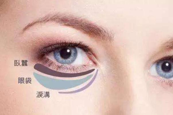 臥蠶和眼袋有什么區(qū)別 臥蠶眼的好處 臥蠶和眼袋有什么區(qū)別 臥蠶眼的好處
