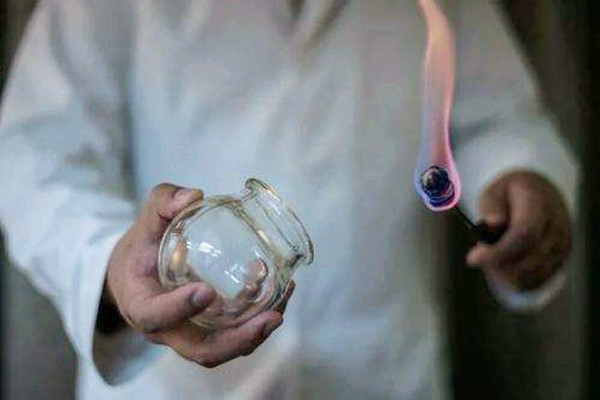 拔火罐能不能減肥 拔火罐減肥效果怎么樣 拔火罐能不能減肥 拔火罐減肥效果怎么樣
