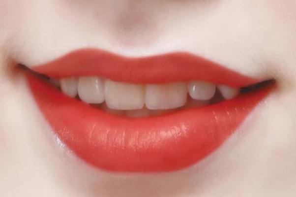 紋唇幾天能恢復(fù)好 紋唇幾天消腫 紋唇幾天能恢復(fù)好 紋唇幾天消腫