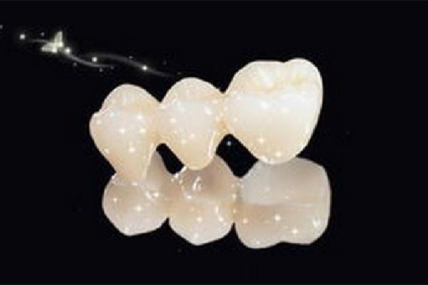 烤瓷牙的材料有幾種 烤瓷牙用什么膠粘最好 烤瓷牙的材料有幾種 烤瓷牙用什么膠粘最好