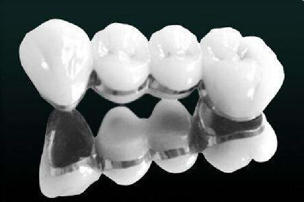 烤瓷牙掉了怎么辦可以粘回去嗎 烤瓷牙掉了多久之內(nèi)必須粘回去 烤瓷牙掉了怎么辦可以粘回去嗎 烤瓷牙掉了多久之內(nèi)必須粘回去