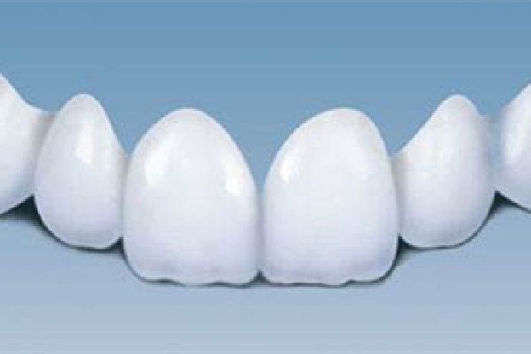 烤瓷牙有縫隙怎么修補(bǔ) 烤瓷牙出現(xiàn)黑線要換嗎 烤瓷牙有縫隙怎么修補(bǔ) 烤瓷牙出現(xiàn)黑線要換嗎